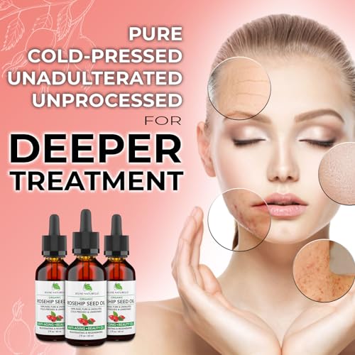 Rosehip Oil, 100% Pure, Raw, Cold Pressed, Unrefined, - Product Imagery