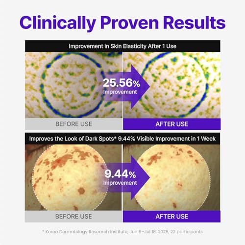 CENTELLIAN 24 Expert Madeca Cream Active Renew PDRN, TECA, - Product Imagery