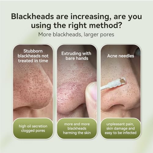 LANBENA Blackhead Remover Nose Strips, Pore Cleansing Mask (1.03 - Product Imagery