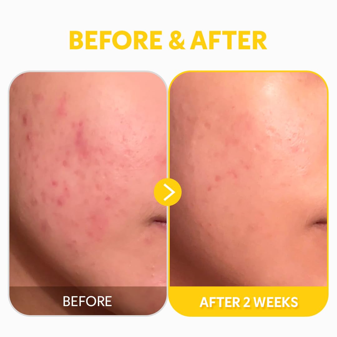 TIRTIR Pure Vitamin C 24% Face Serum – Dark Spot Remover for - TIRTIR