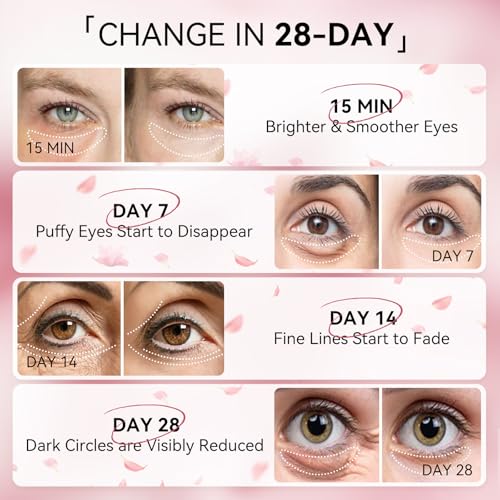 BREYLEE Flamingo Pink Eye Mask–60 Pcs-Puffy Eyes and Dark - Product Imagery