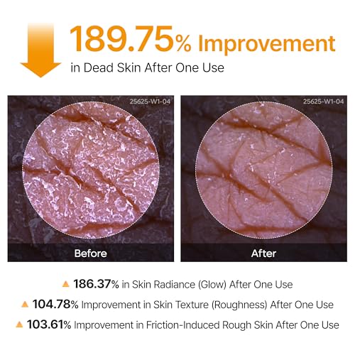 n Peel Shot Kojic Acid Turmeric Body Exfoliator Spray 6.76 fl.oz - Product Imagery