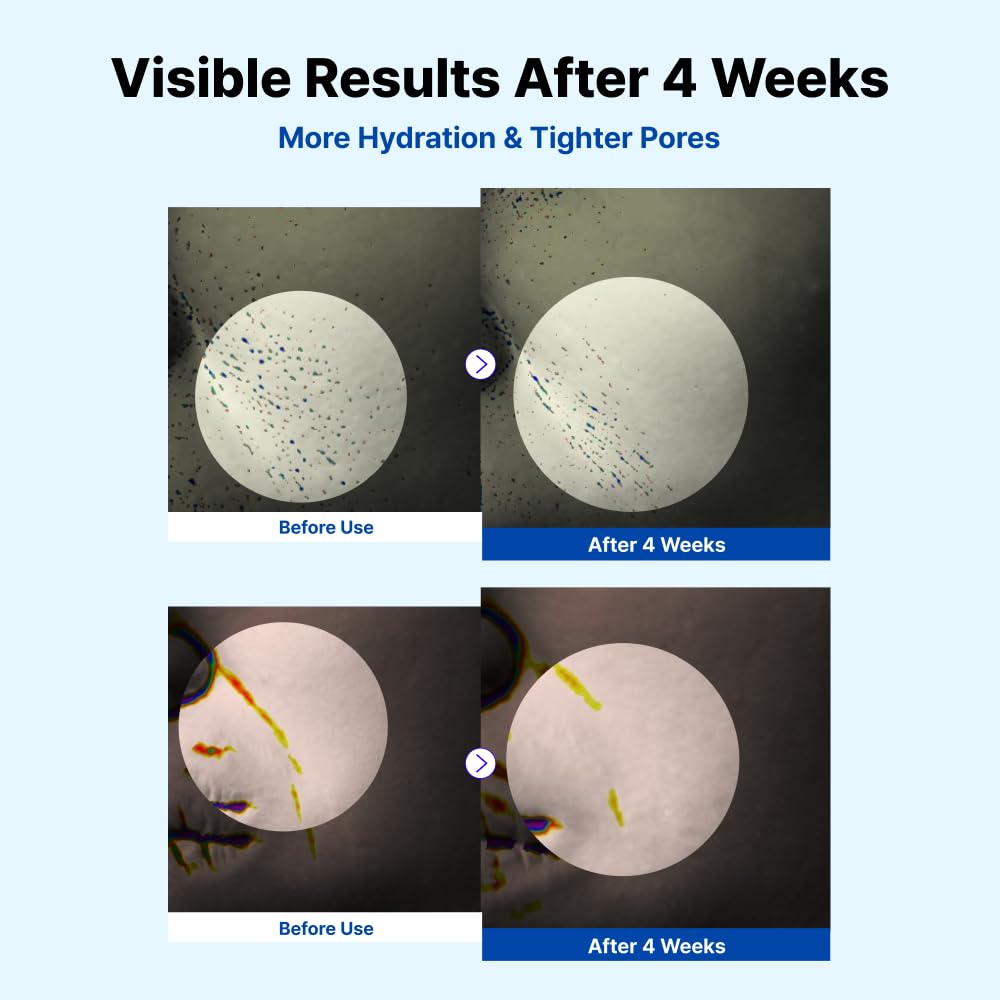 NIDA Youthful Formula™ Ultimate Moisturizing Cream - NIDA Official Product View 5