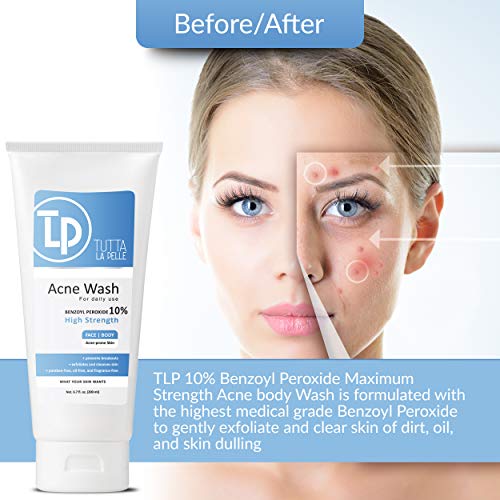 Benzoyl Peroxide Body Wash 10% - Acne Face Wash & Acne Body Wash - Product Imagery