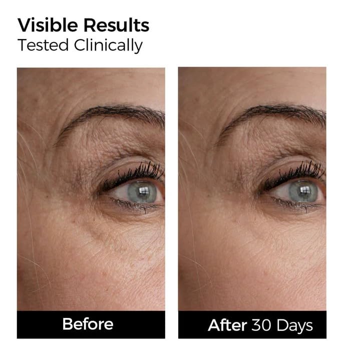 Hydrating Repair Serum Set: 3% Hyaluronic Acid & Collagen, 60 Ct - Product Imagery