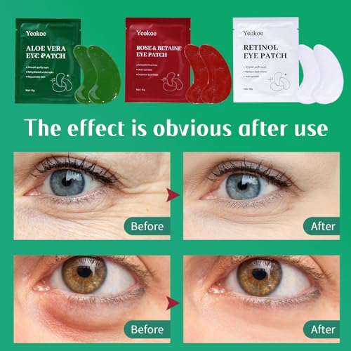 Under Eye Patches For Puffy Eyes and Dark Circles Wrinkle,30 - Product Imagery