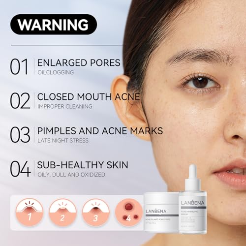 LANBENA 3 in 1 Blackhead Remover Set Pore Strips 30g+Pore Serum - Product Imagery