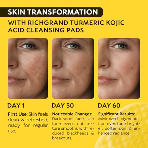 Turmeric Kojic Acid Cleansing Pads for Face - Exfoliating - Product Imagery