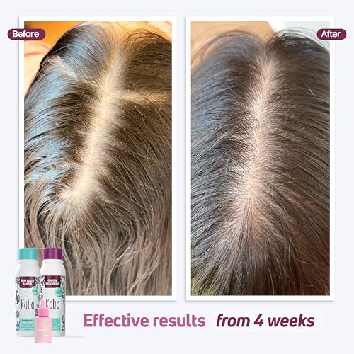 Kaba Hair Growth Kit – Onion Shampoo, Mask & Tonic by D'Luchi