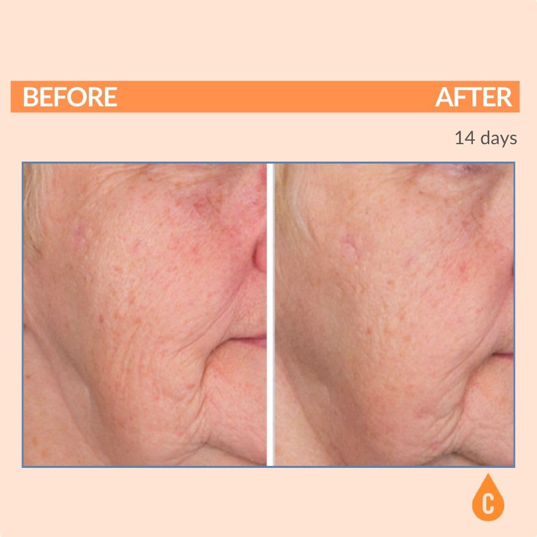 Serious Skincare Vitamin C Serum for Face Anti Aging for - Serious Skincare Official Imagery - 3