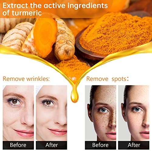 Turmeric Serum for Dark Spots，2 PCS Face Serum Turmeric Dark - Product Imagery