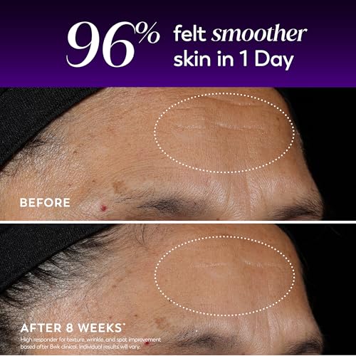 Olay Regenerist Resurfacing Retinol Serum, Renew, Anti-Wrinkle - Product Imagery