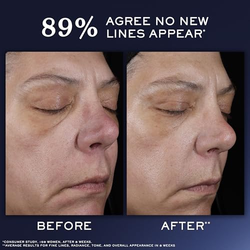 Lancôme Génifique Ultimate Recovery Serum - Hydrating Anti Aging  - Product Imagery