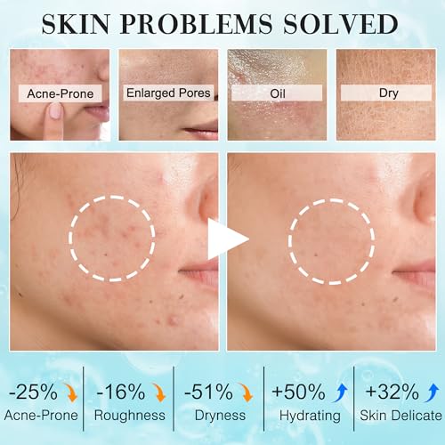 Teen Women Gifts,Skin Care,Skincare,Hydrate,Oil Control,Pore - Product Imagery