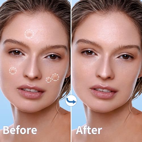 Pimple Patches for Face, 4 Size 300 Counts Hydrocolloid Acne - Product Imagery