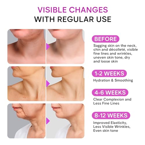 Neck Firming Cream with Retinol, Collagen & Hyaluronic Acid - - Product Imagery