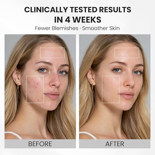 Wireless Red Light Therapy Face Mask, 4 Modes for Wrinkles, Fine - Product Imagery