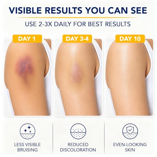 Arnica Bruise Cream with Vitamins K, C & E, Soothing Hydrating - Product Imagery