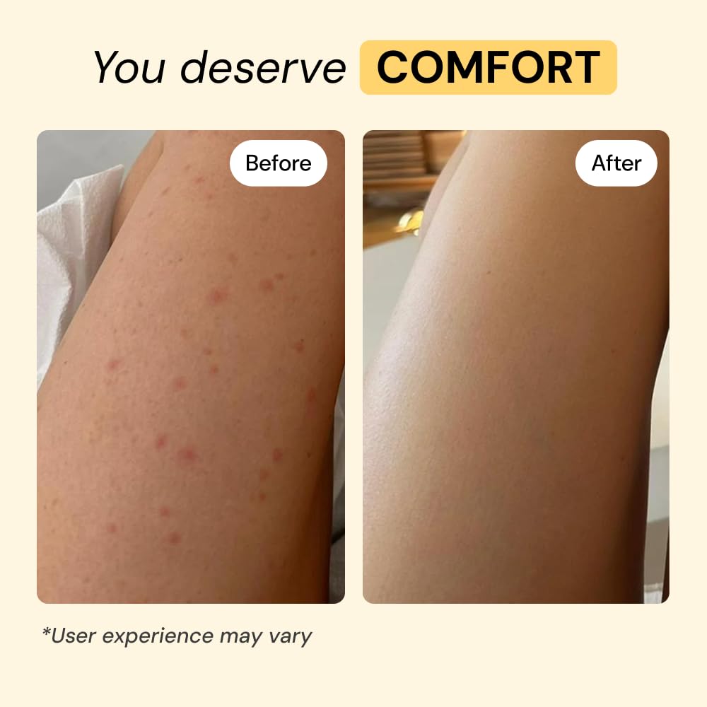 Thyme Tea Tree Flare Care - MyMagicHealer Official Imagery - 5
