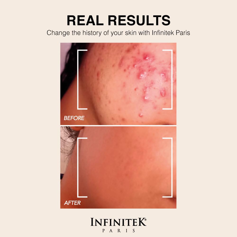 Infinitek Paris Retinol Face Moisturizer - Infinitek Official Imagery - 6