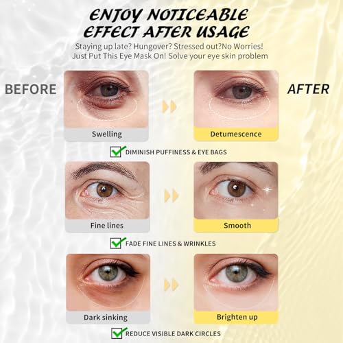 Maskiss Under Eye Patches Variety Pack (8 Pairs), Eye Masks for - Product Imagery