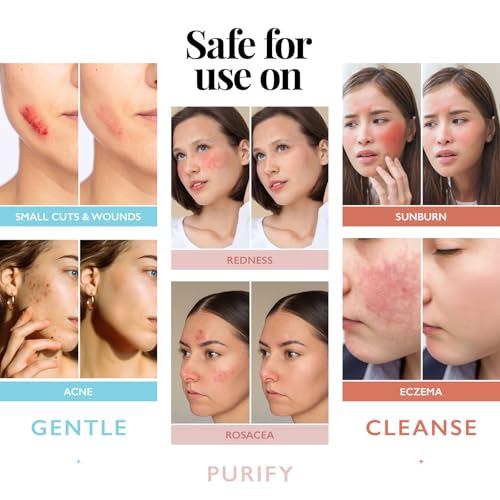 Hypochlorous Acid Spray for Face and Skin; Facial Cleanser | 8oz - Product Imagery