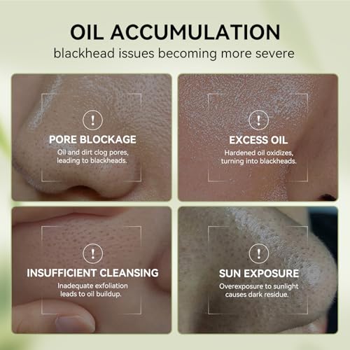 LANBENA Blackhead Remover Nose Pore Strips Kit Mask 30g+Pore - Product Imagery