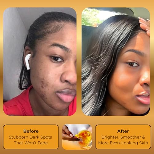 Turmeric Exfoliating Body Scrub for Uneven Skin Tone – Sea Salt - Product Imagery