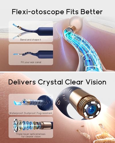 Bebird R37R Ear Wax Removal Tool Camera, Flexible Scope and - Product Imagery