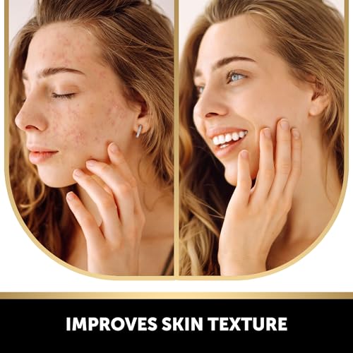 VALITIC Kojic Acid Soap for Hyperpigmentation with Turmeric 2 - Product Imagery