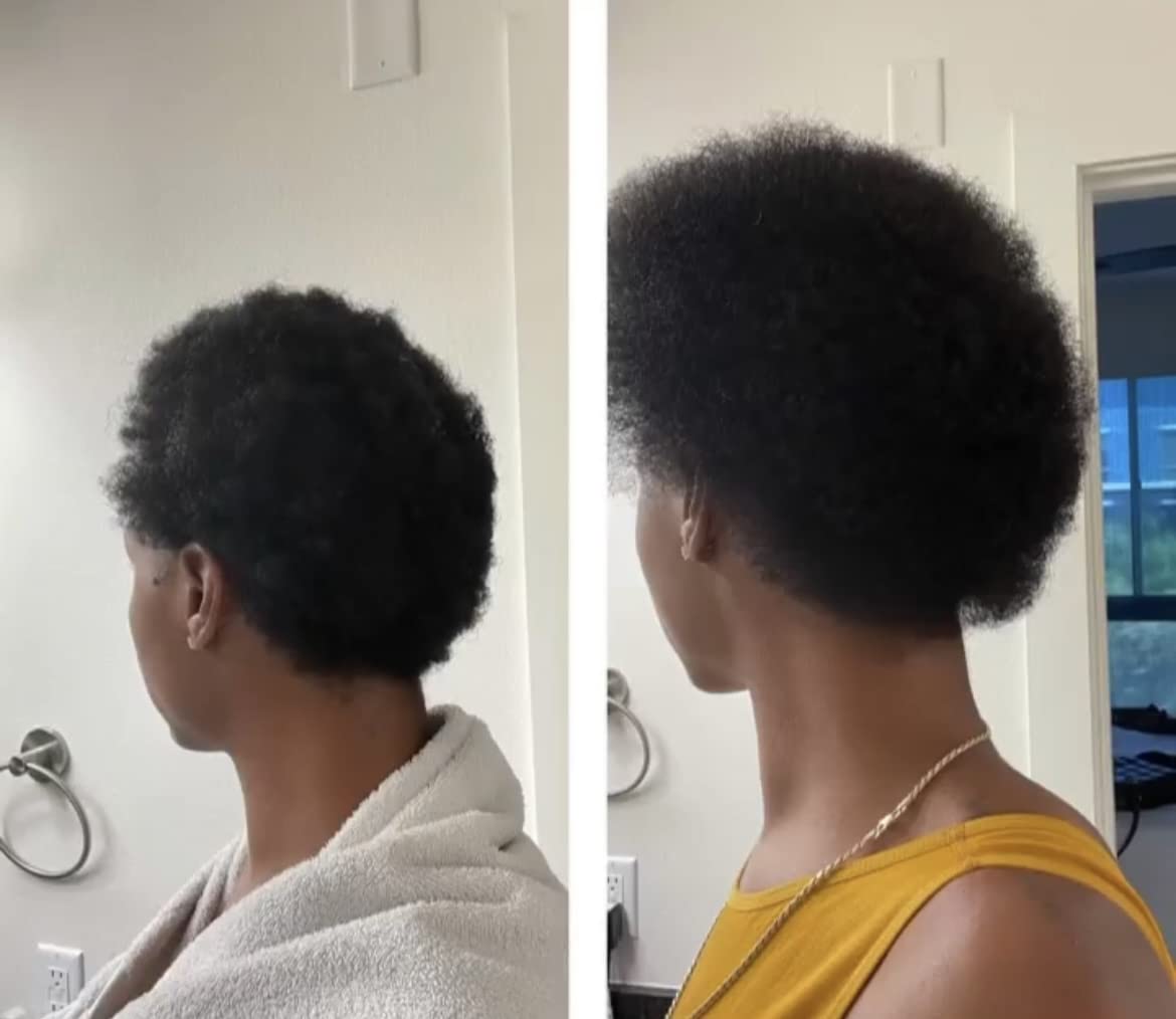Bur Bur Growing Season Hair Growth And Repair Oil - With Burdock & Nettle Oil - Bur Bur Official Product View 7