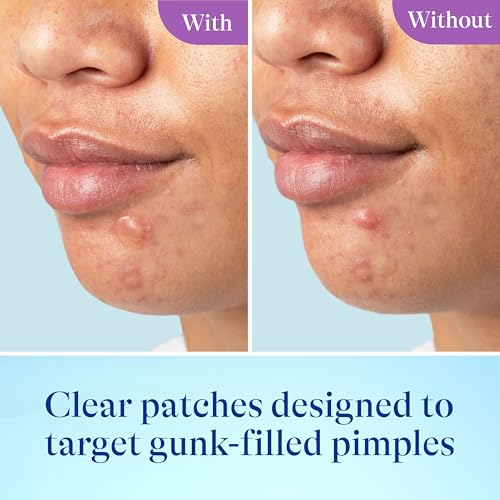 Differin Power Pimple Patches, Hydrocolloid Acne Treatment, 23ct - Product Imagery