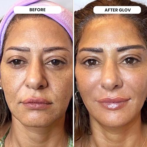 Glov Beauty Micro Infusion System for Face & Lips – 0.25mm 24k - Product Imagery
