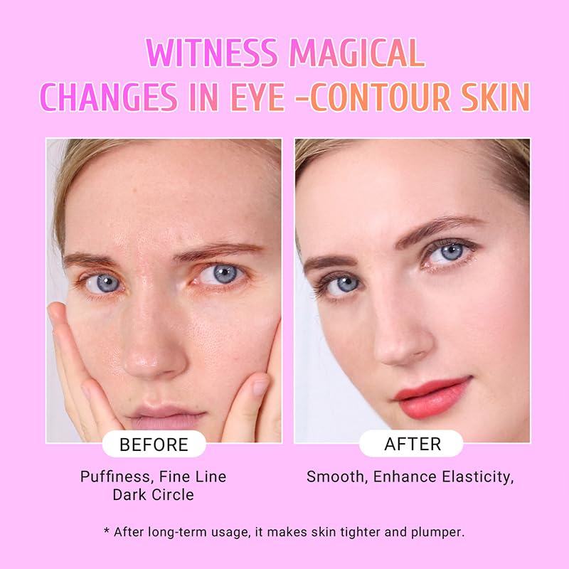 PEAUAMIE Under Eye Patches Gold and Hyaluronic Acid for puffy - Product Imagery