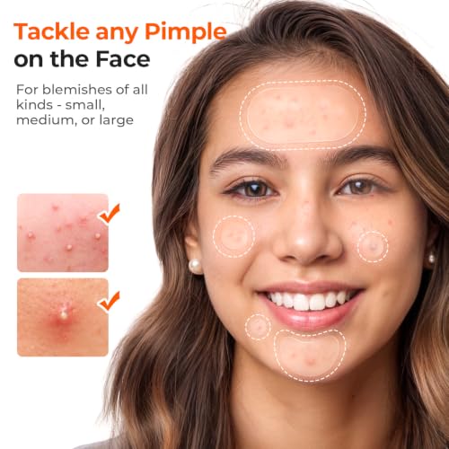 TKTK 443 Count Pimple Patches for Face, Hydrocolloid Acne Cover - Product Imagery