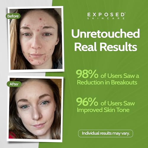 Exposed Skin Care Moisture Complex Oil-Free Daily Face - Product Imagery