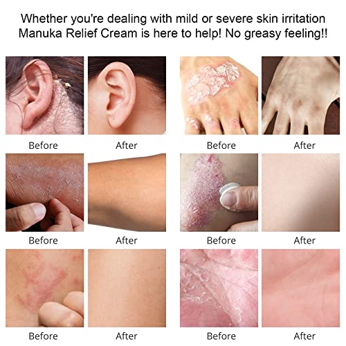 Organic Manuka Honey Lotion Cream with Colloidal Oatmeal - - Product Imagery
