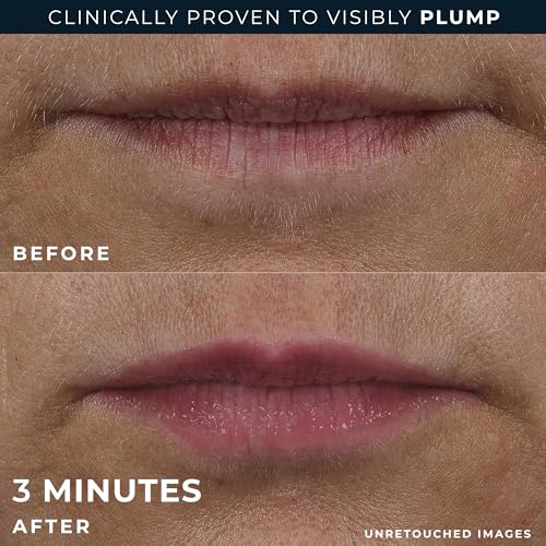 RoC Derm Correxion Lip Volumizer, Hyaluronic Acid Lip Plumper - Product Imagery
