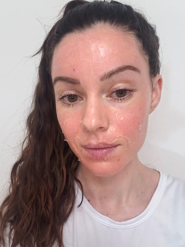 Jessner Chemical Peel Solution 35% – Professional Exfoliating - Product Imagery