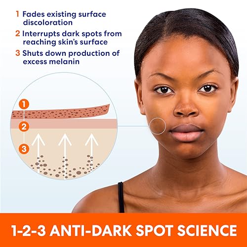 Palmer's Anti Dark Spot Face Cream with Vitamin E & Niacinamide ( - Product Imagery