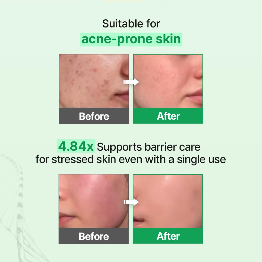 Zipiderm EGF Skin Barrier Cream Toner Korean Milky Toner 5 - Z+piderm Official Imagery - 6