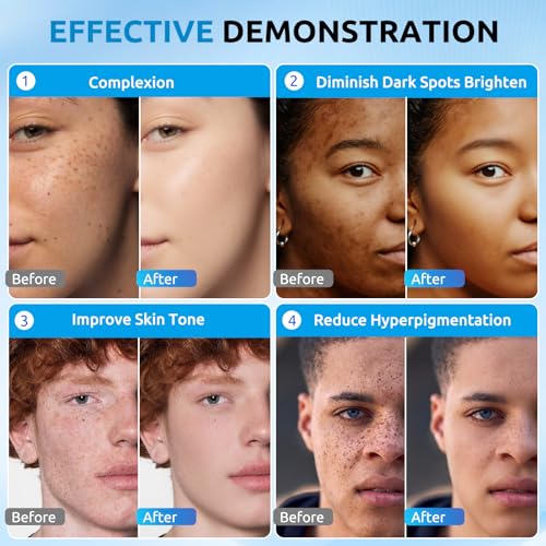 HANYWIL Dark Spot Remover for Face & Body Serum,Dark Spot - Product Imagery