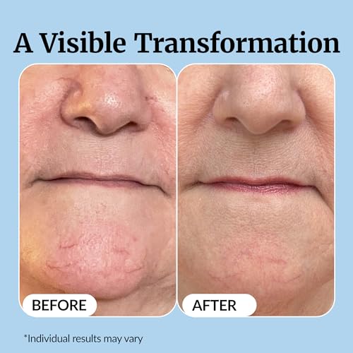Vibriance Super C Vitamin C Serum for Mature Skin, 1 fl oz - Product Imagery
