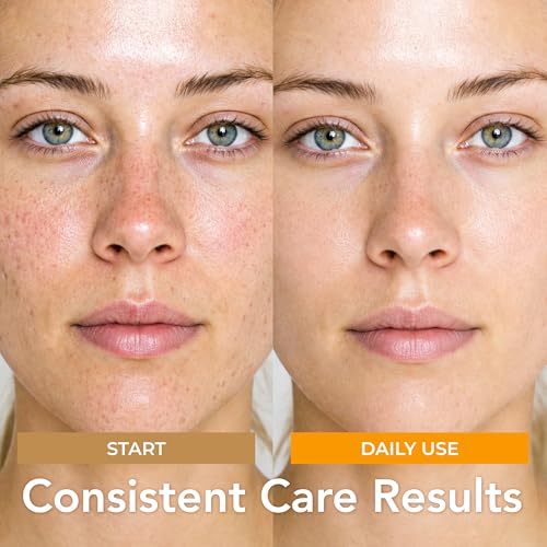 PatchRx Kojic Acid Pads, Kojic Acid Face & Body Cleansing Pads, - Product Imagery