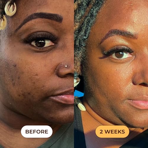 Glo Melanin Turmeric Brightening Scrub for Dark Spots [4 oz] - Product Imagery
