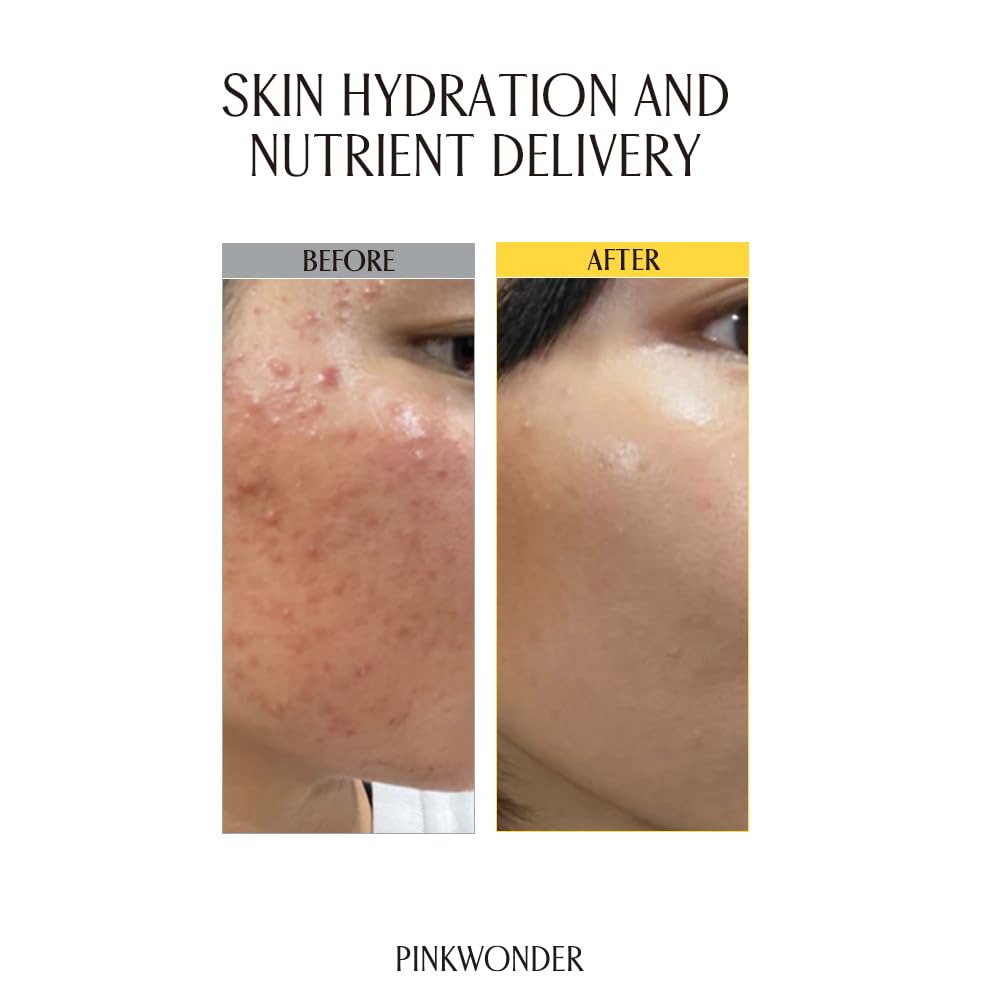 Jojoba Facial Toner Hydrating for Dry Sensitive Skin 6 76oz - PINKWONDER Official Imagery - 4