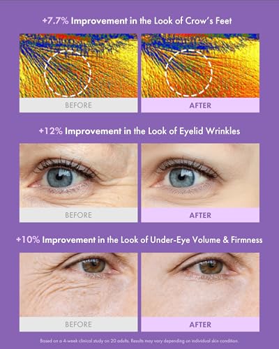 MAXCLINIC PDRN Eye Cream - Under Eye Care with Exosomes 0.68 fl - Product Imagery