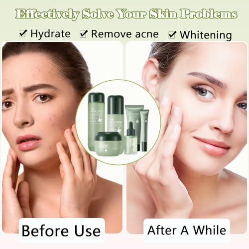 Avocado Facial Set - 6PCS, Cleansing to Lotion to Rich Cream, - Product Imagery