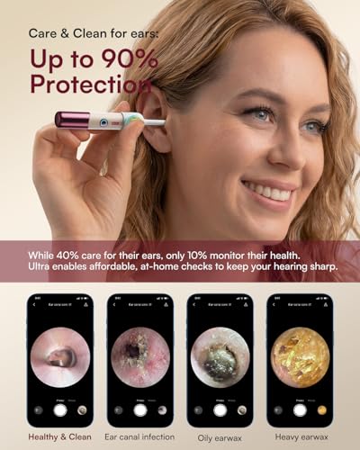 Bebird Ultra X Ear Wax Removal Kit, 4K HD Ear Cleaner Camera - Product Imagery