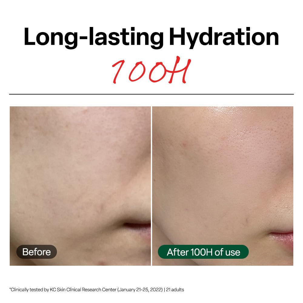 Dr.G R.E.D. Blemish Clear Soothing Face Cream, 2.36 fl oz - Dr.G Official Product View 4
